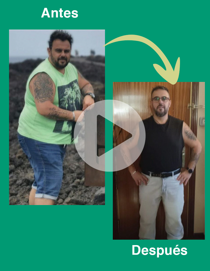 Ana Ruiz Antes y después